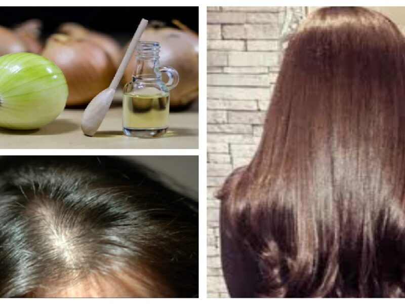 Hair Fall Home Remedies