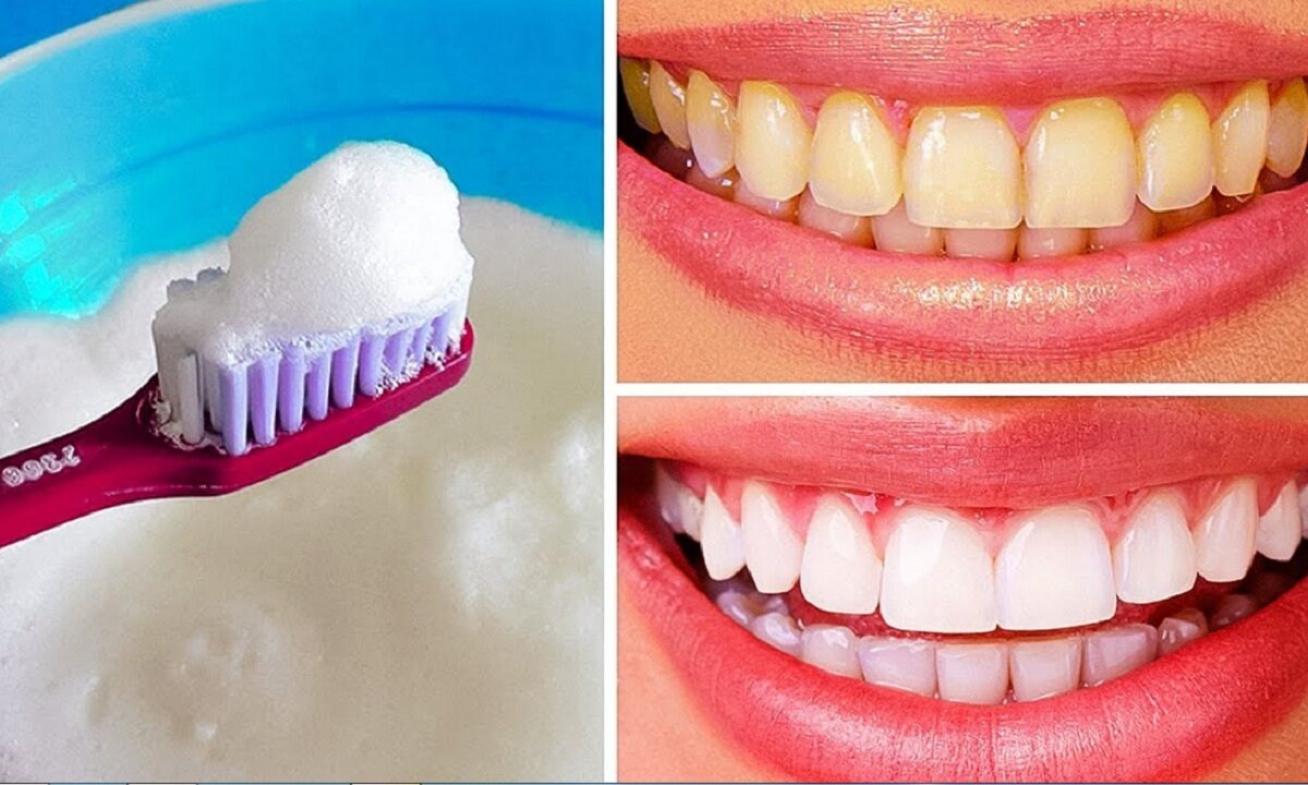 teeth whitening home remedies