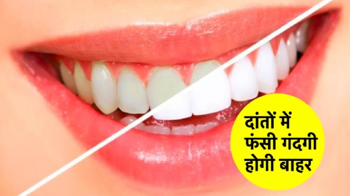 Healthy Teeth Tips