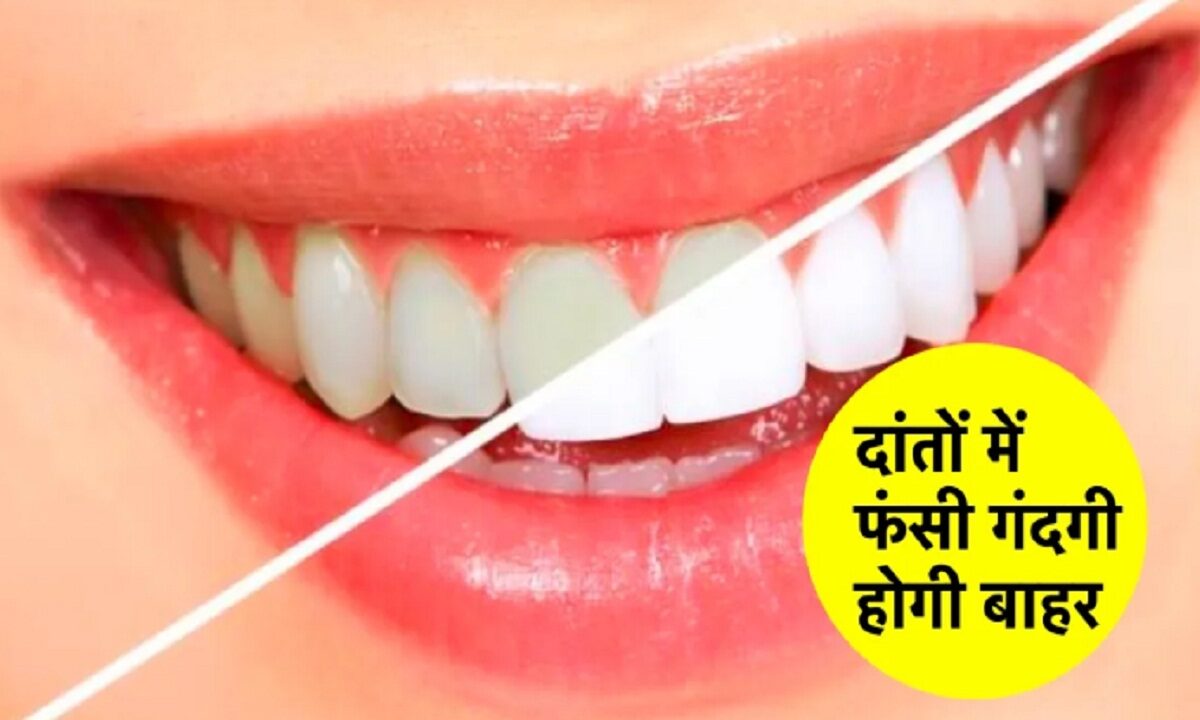 Healthy Teeth Tips