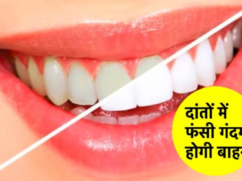 Healthy Teeth Tips