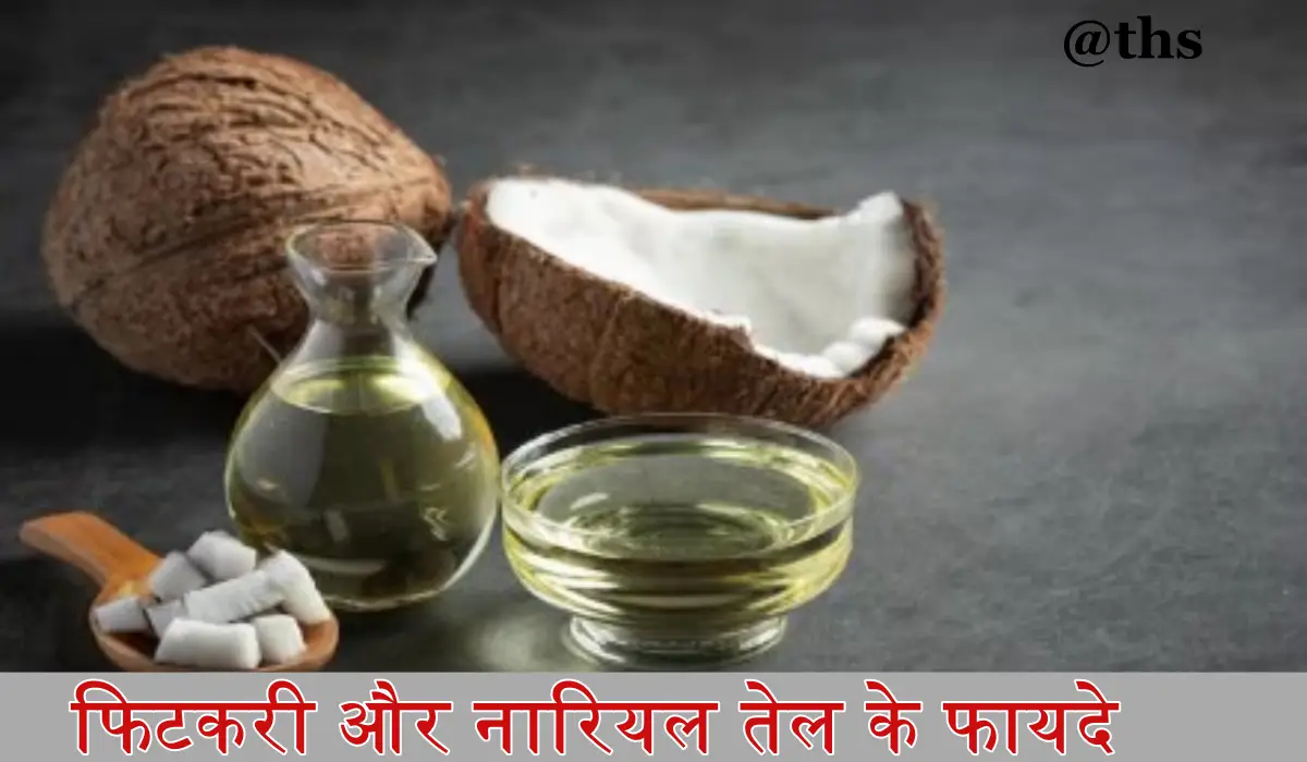 Coconut oil Remedies