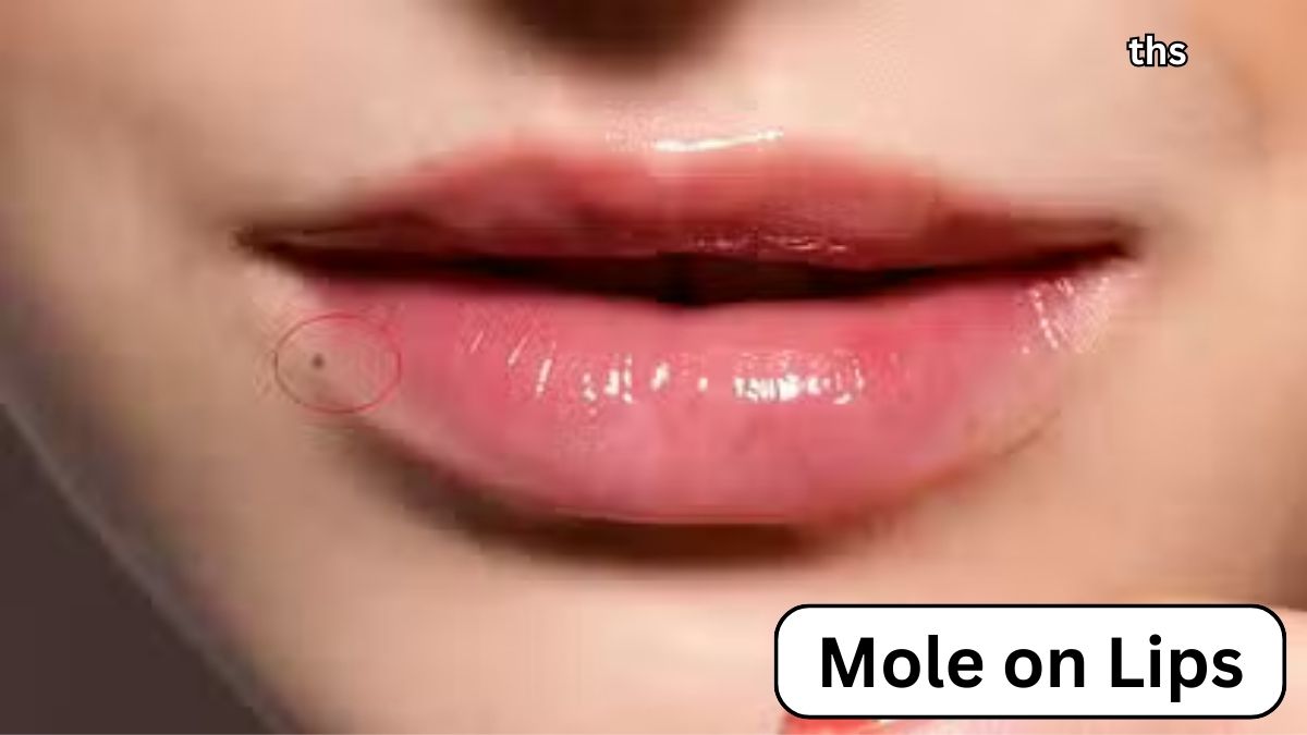 Mole on Lips