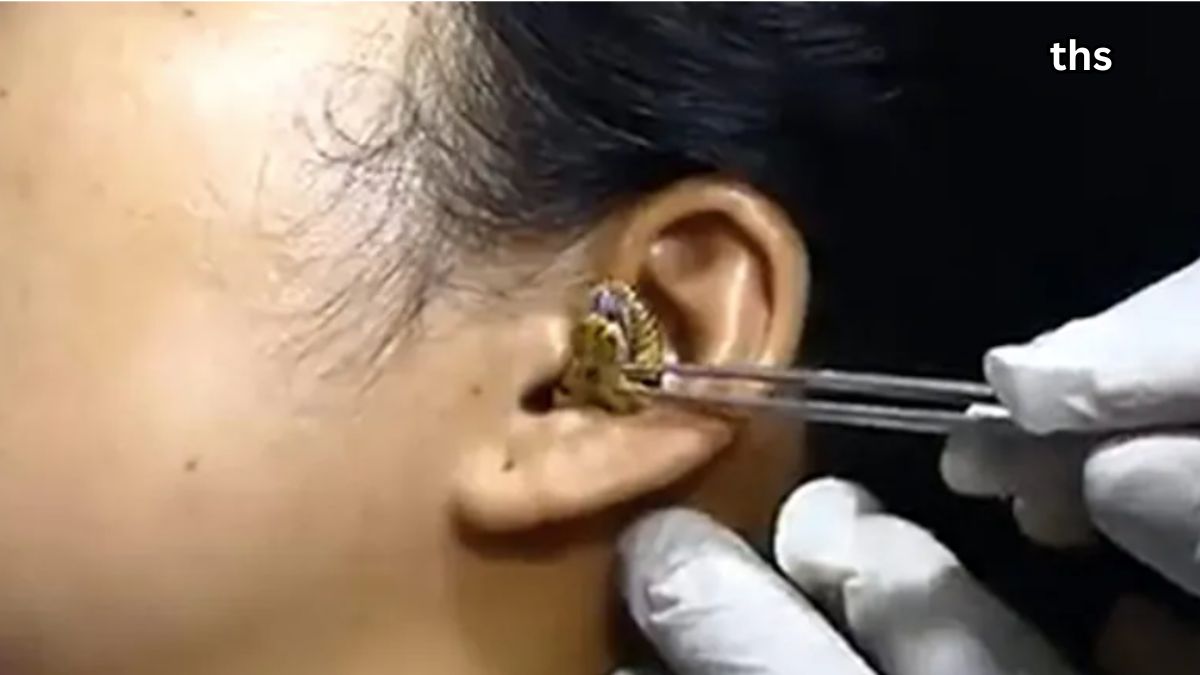 Remove Ear Wax Instantly with These Home Remedies